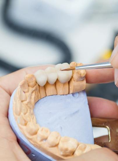 A model showing tech working on dental bridge