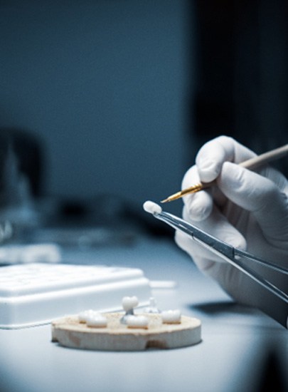 a lab technician preparing dental crowns in Chula Vista