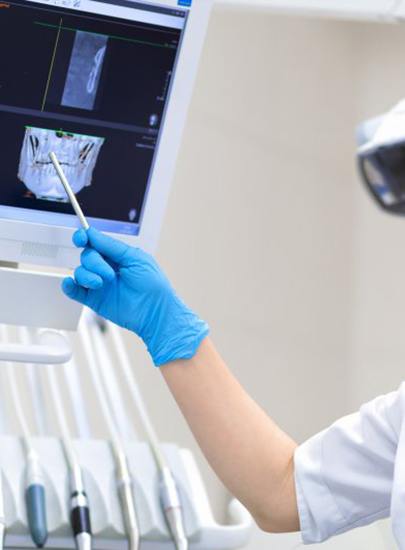 a dentist explaining dental implant technology to a patient