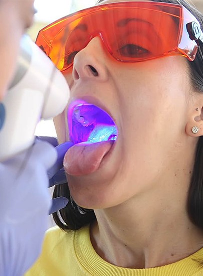 Woman receiving an oral cancer screening