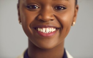 a woman smiling and showing the gap between her two front teeth