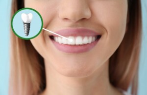 Woman with a dental implant smiling