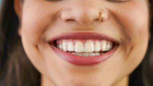 Woman smiling while wearing Invisalign