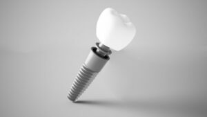 Dental implant model on a gray background