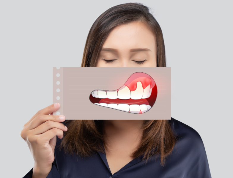 Woman holding cartoon mouth with red gums over her mouth